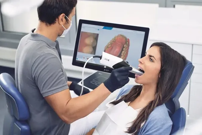 口腔内スキャナーによるデジタル印象